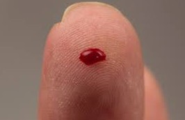 Hlavním projevem hemofilie je krvácení